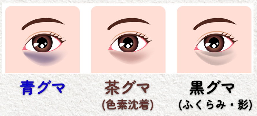 青グマ 茶グマ 黒グマ