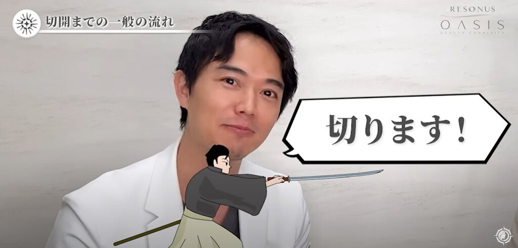 切開フェイスリフト