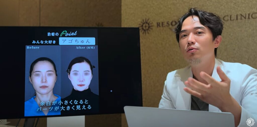 アゴちゅん 山口院長 リゾナス