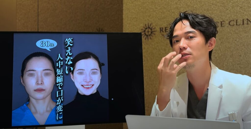 人中短縮 山口院長