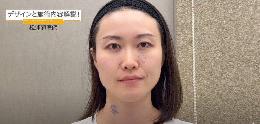 自然な若返り　デザインのポイント