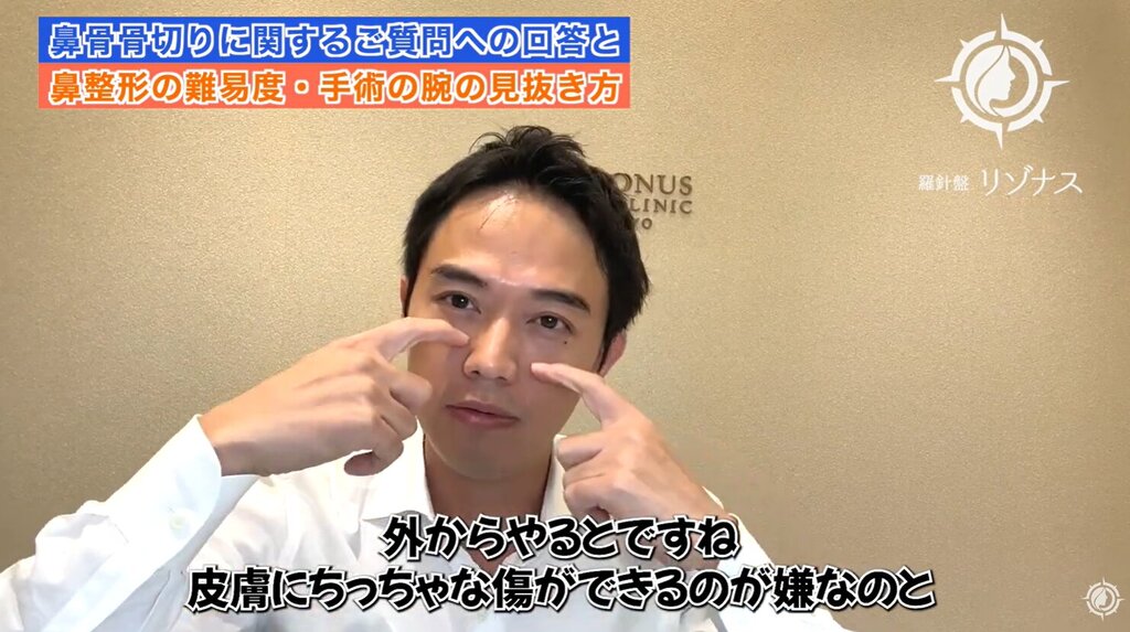 鼻骨骨切り　外側