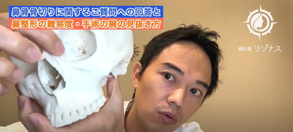 鼻骨骨切り　内側　外側