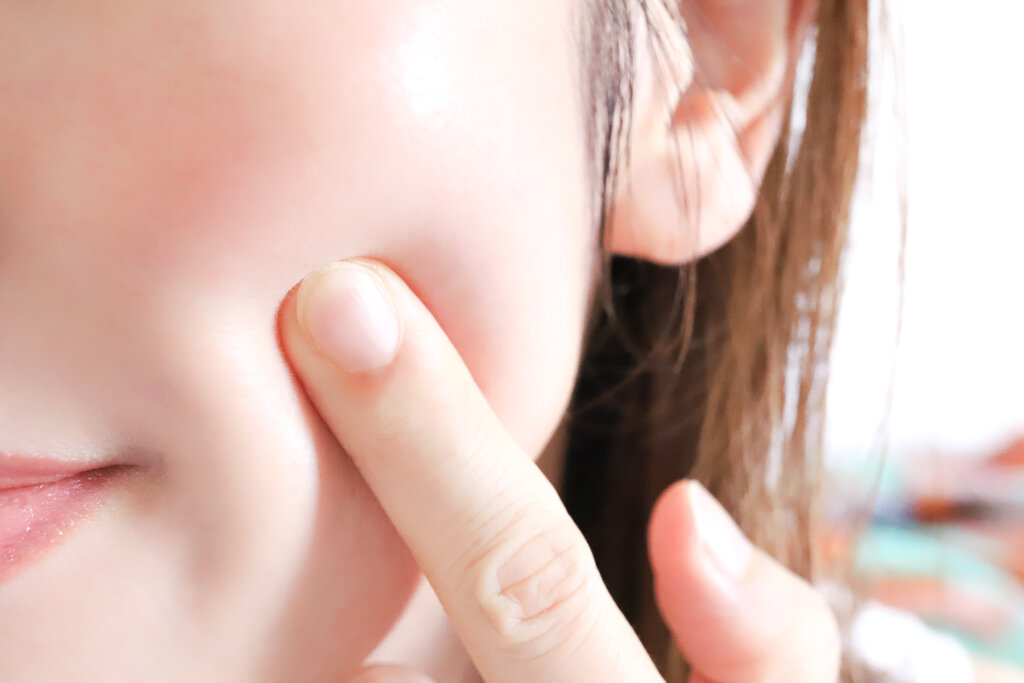 肌状態も施術検討の大切な要素