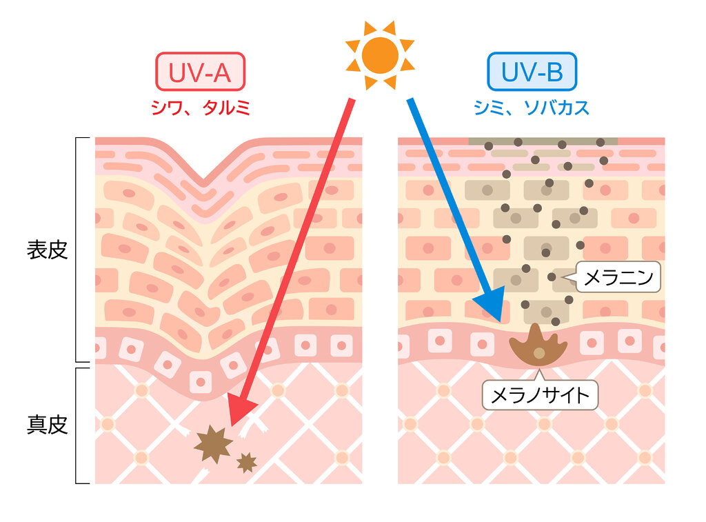 UVAとUVBの違いを知ろう