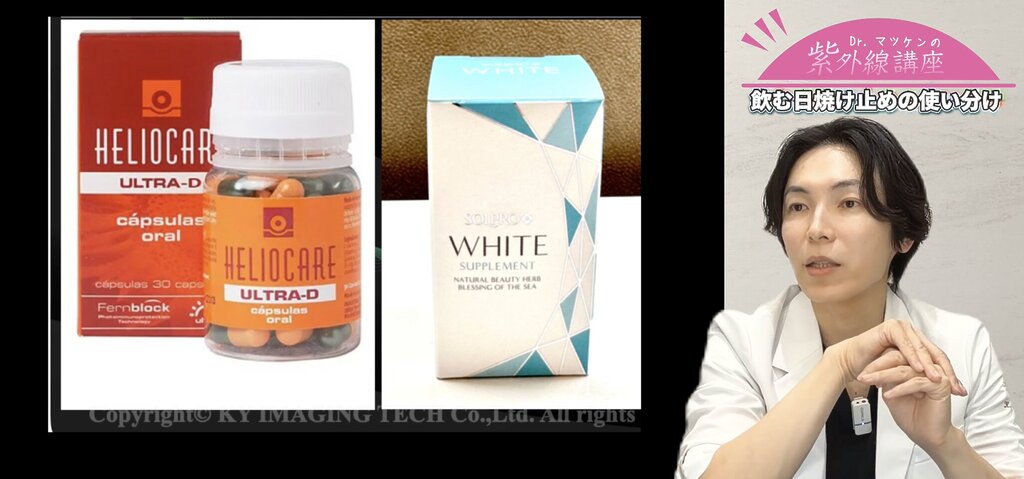ヘリオケアとソルプロの使い分け