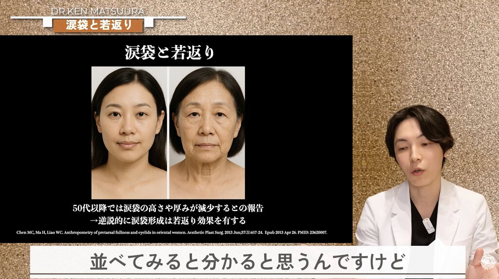加齢で失われる涙袋の高さ・厚み
