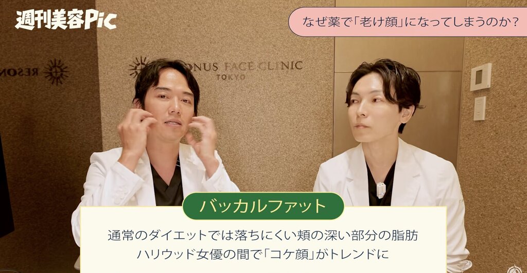 バッカルファット コケ顔