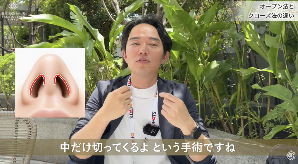 クローズ法は鼻先を切らない術式