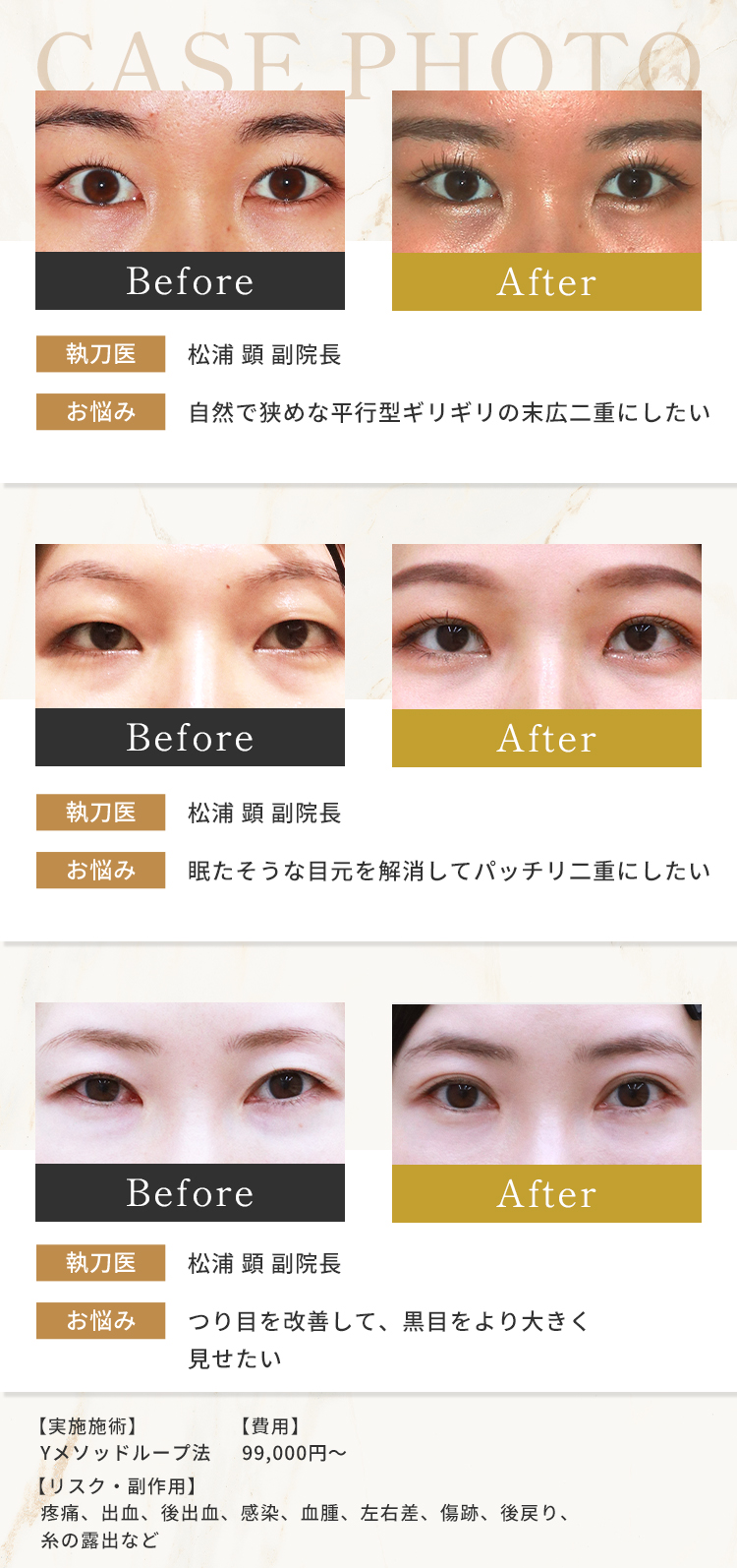目元の症例写真