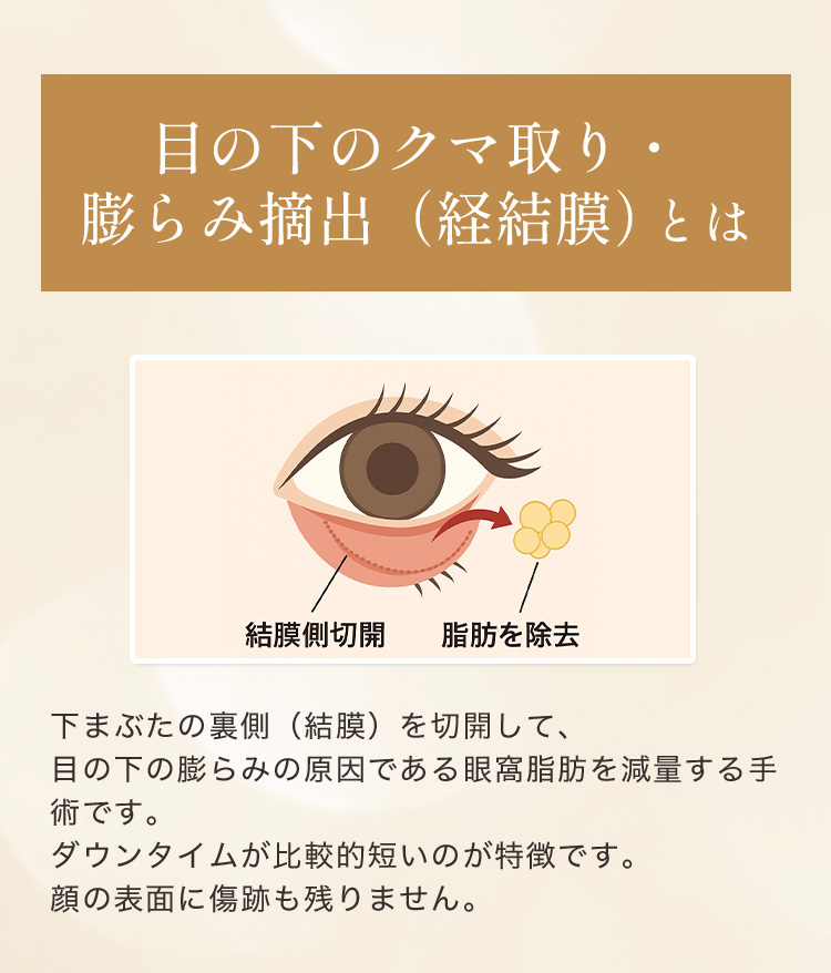 リゾナスのクマ取りがおすすめです