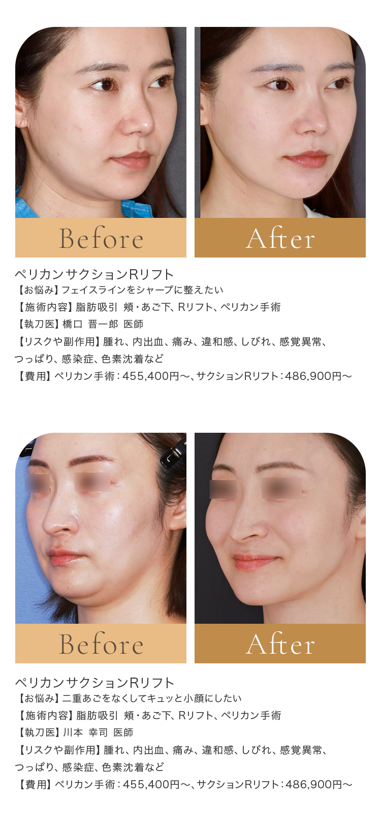 症例紹介