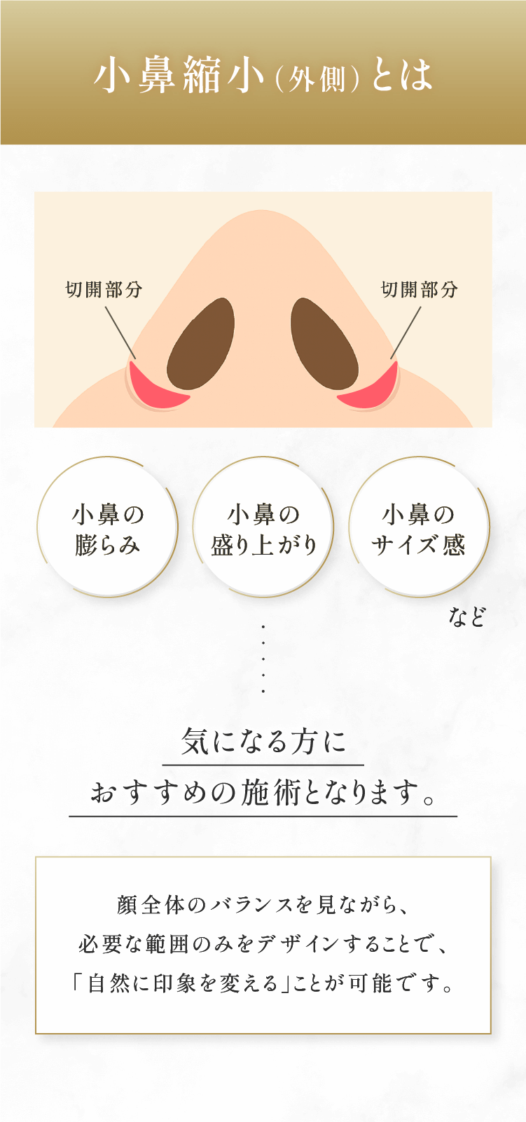 小鼻縮小（外側）とは