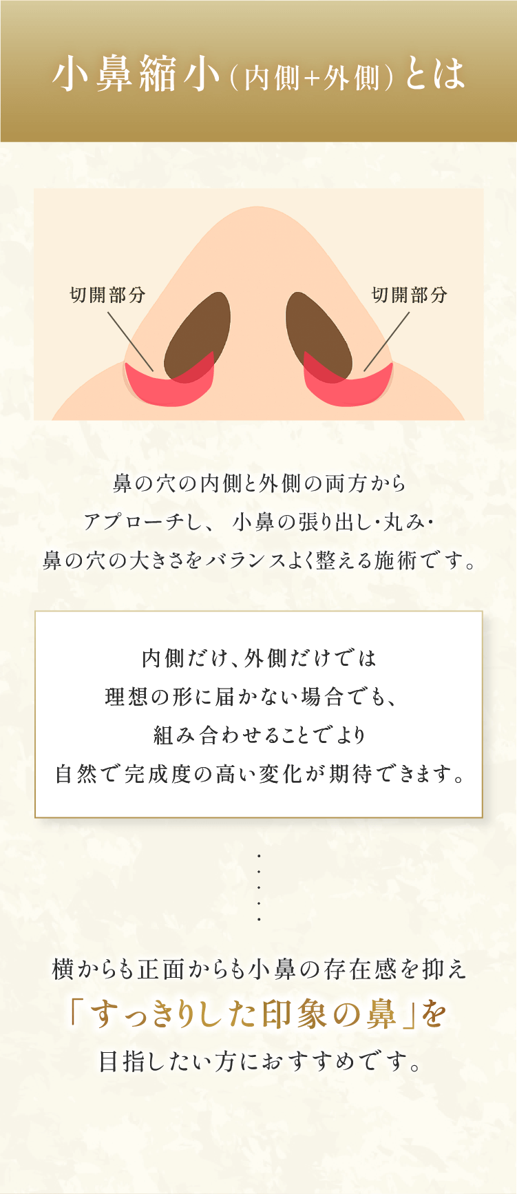小鼻縮小（内側＋外側）とは