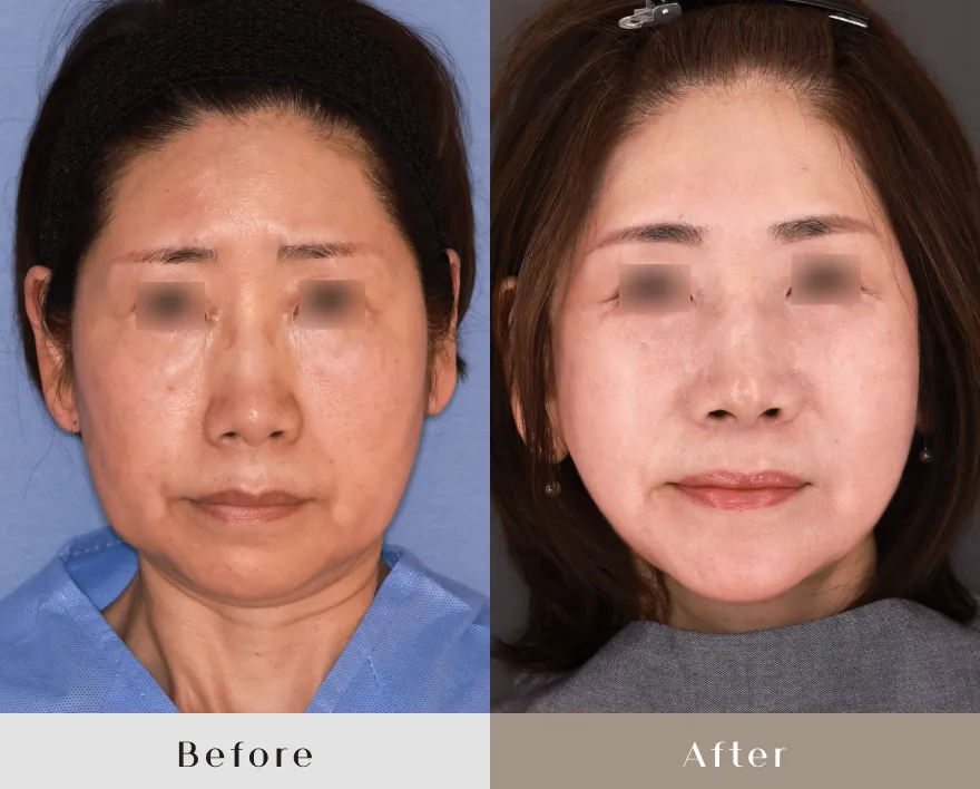 50代後半女性