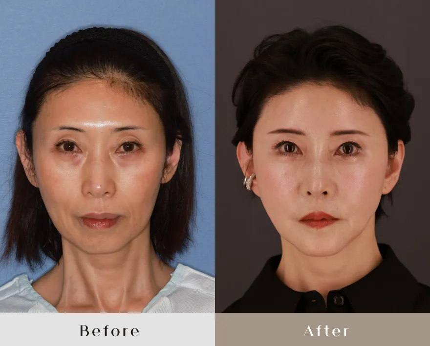 50代前半女性　正面