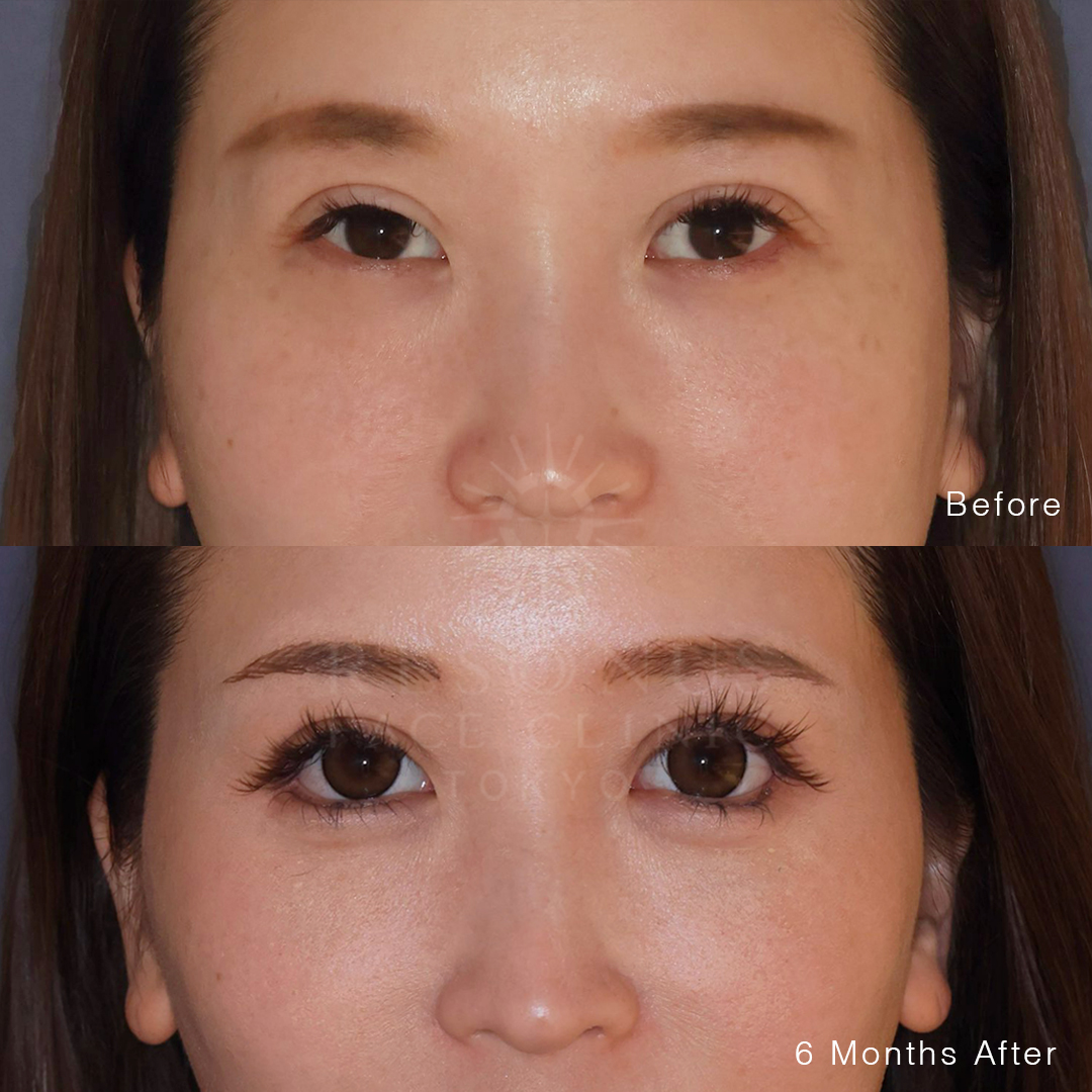 【30代】全方向目拡大術～カラコンに負けないくらい目を大きくしたい